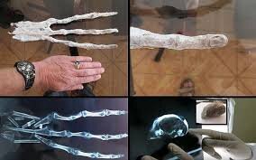 اسرار پنج‌انگشت انسان/ چرا دست‌وپای ما دقیقاً پنج‌انگشت دارد؟